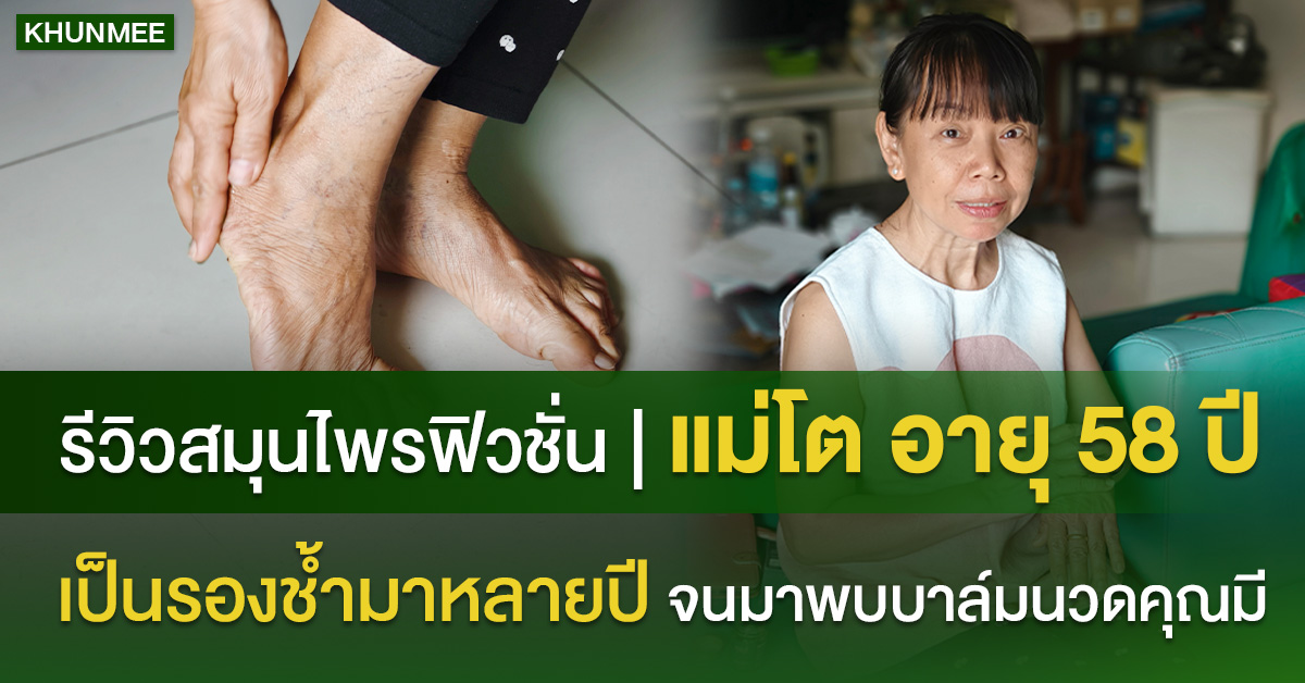 รีวิว สมุนไพรฟิวชั่น | “แม่โต” วัย 58 ปี เป็นรองช้ำหลายปี แต่ดีขึ้นเพราะบาล์มนวดสูตรนี้
