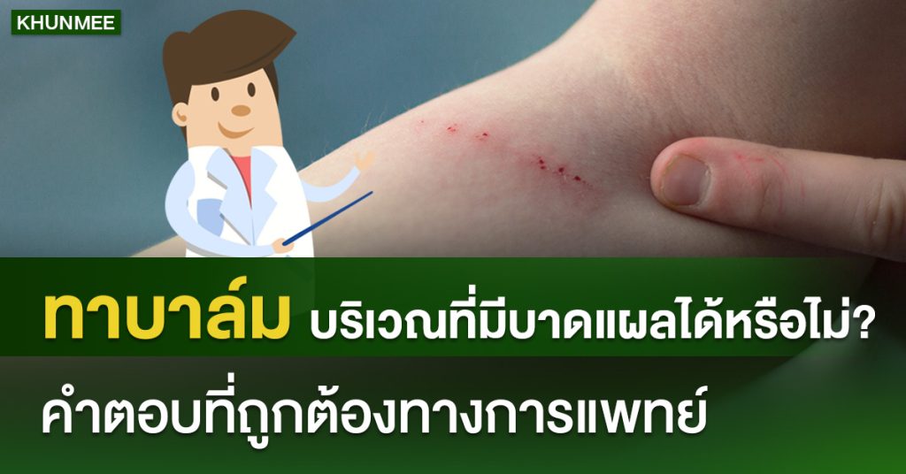 ทาบาล์มนวดบริเวณที่มีแผลได้มั้ย