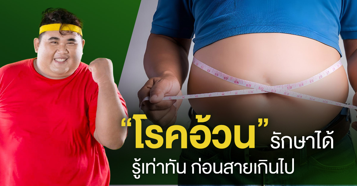 โรคอ้วน รักษาได้ – รู้เท่าทันก่อนสายเกินไป