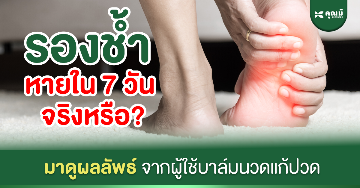 รองช้ำหายได้ใน 7 วันจริงหรือ? มาดูผลลัพธ์จากผู้ใช้บาล์มนวดแก้ปวด