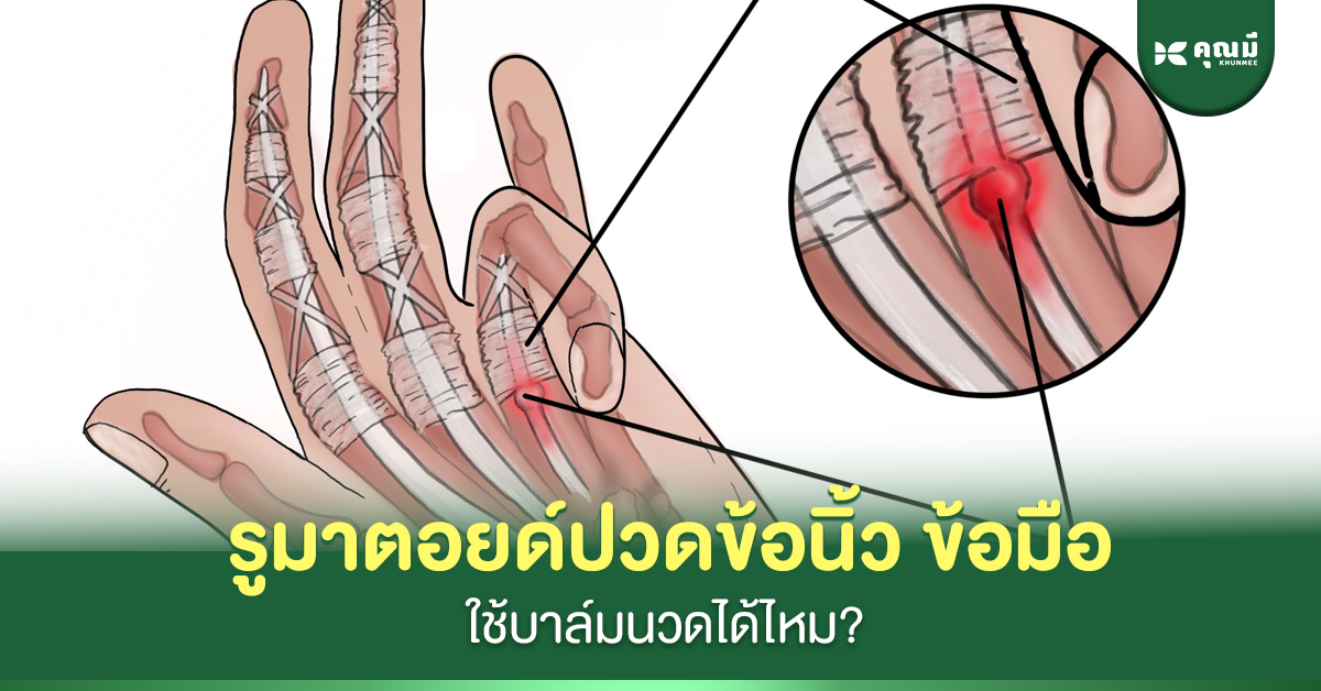 รูมาตอยด์ปวดข้อนิ้ว ข้อมือ ใช้บาล์มนวดได้ไหม?