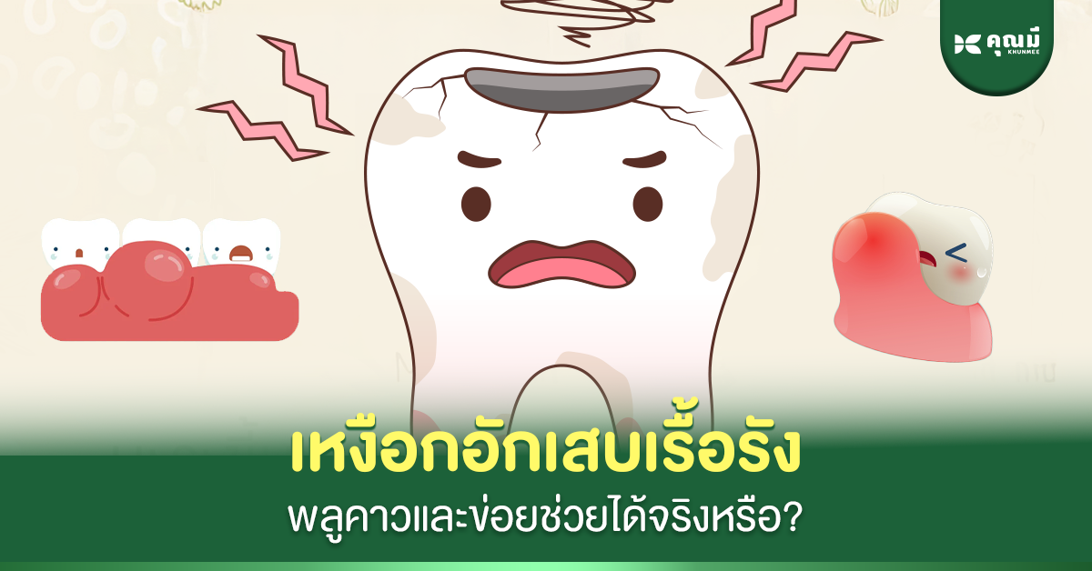 เหงือกอักเสบเรื้อรัง พลูคาวและข่อยช่วยได้จริงหรือ?